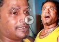 মুখত অজস্ৰ ফুটা : এসময়ত বলিউডৰ চেলিব্ৰেটি আজি পথৰ চাহ দোকানী