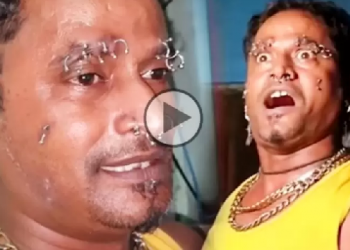 মুখত অজস্ৰ ফুটা : এসময়ত বলিউডৰ চেলিব্ৰেটি আজি পথৰ চাহ দোকানী