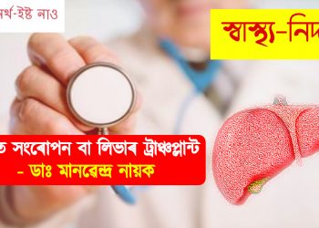 যকৃত সংৰোপন বা লিভাৰ ট্ৰাঞ্চপ্লান্ট