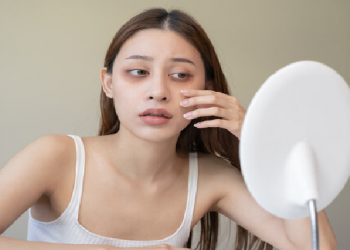 dark circles