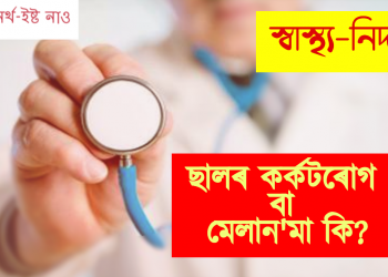 ছালৰ কৰ্কটৰোগ বা মেলান’মা কি?
