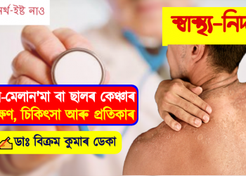 নন-মেলান’মা বা ছালৰ কেঞ্চাৰ : কাৰণ, লক্ষণ, চিকিৎসা আৰু প্ৰতিকাৰ