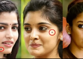 শৰীৰৰ কোন অংশত তিল থাকিলে কি হয়? শৰীৰত থকা তিলৰ অৱস্থানে নিৰ্ণয় কৰিব আপোনাৰ ভাগ্য
