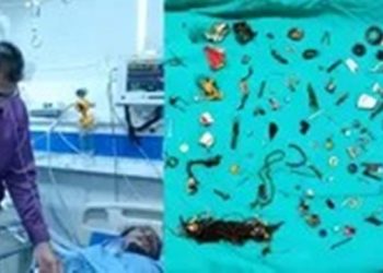 ইয়াৰফোন, লকেট, স্ক্ৰু, ৰাখী কি যে নাছিল – পেট নহয় যেন মিউজিয়ামহে! স্তম্ভিত চিকিৎসক