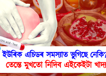 ইউৰিক এচিডৰ সমস্যাত ভুগিছে নেকি? তেন্তে ভুলতো মুখত নিদিব এইকেইটা খাদ্য