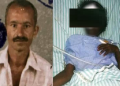 Man Chops Off Woman's Nose