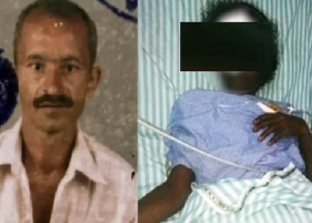 Man Chops Off Woman's Nose