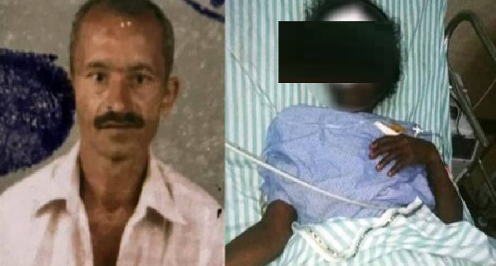 Man Chops Off Woman's Nose