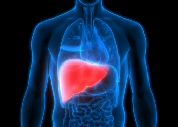 fatty liver