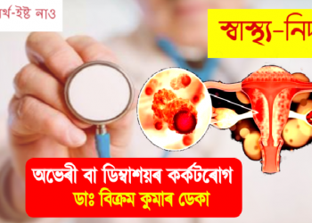 Ovarian Cancer