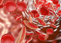 Low Iron Levels Symptoms