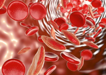 Low Iron Levels Symptoms