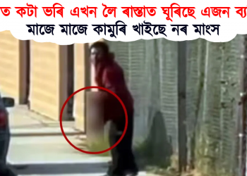হাতত কটা ভৰি এখন লৈ ৰাস্তাত ঘূৰিছে এজন ব্যক্তি : মাজে মাজে কামুৰি খাইছে নৰ মাংস
