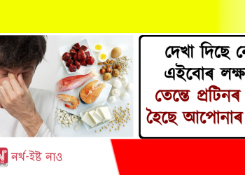 দেখা দিছে নেকি এইবোৰ লক্ষণে? তেন্তে প্ৰটিনৰ অভাৱ হৈছে আপোনাৰ দেহত