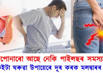 আপোনাৰো আছে নেকি পাইলছৰ সমস্যা? এইকেইটা ঘৰুৱা উপায়েৰে দূৰ কৰক মলদ্বাৰৰ যন্ত্ৰণা