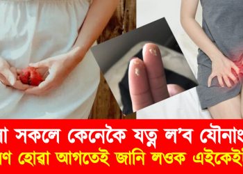 মহিলা সকলে কেনেকৈ যত্ন ল’ব যৌনাংগৰ? সংক্ৰমণ হোৱা আগতেই জানি লওক এইকেইটা কথা