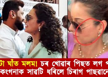 কটা ঘাঁত মলম! চৰ খোৱাৰ পিছত লগ পাই কংগনাক সাৱটি ধৰিলে চিৰাগ পাছৱানে