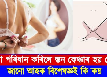 টান বক্ষবন্ধনী বা ‘ব্ৰা’ পৰিধান কৰিলে স্তন কেঞ্চাৰ হয় নেকি? জানো আহক বিশেষজ্ঞই কি কয়