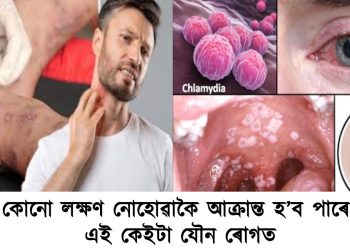 কোনো লক্ষণ নোহোৱাকৈ আক্ৰান্ত হ’ব পাৰে এই কেইটা যৌন ৰোগত : এতিয়াই জানি লওক