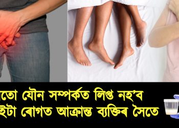 ভুলতো যৌন সম্পৰ্কত লিপ্ত নহ’ব এইকেইটা ৰোগত আক্ৰান্ত ব্যক্তিৰ সৈতে : পৰিণাম হ’ব পাৰে ভয়ংকৰ