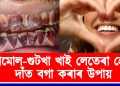 তামোল-গুটখা খাই চেকা লগোৱা দাঁত বগা কৰাৰ উপায়