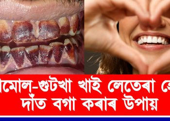 তামোল-গুটখা খাই চেকা লগোৱা দাঁত বগা কৰাৰ উপায়