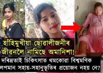 হাঁহিমুখীয়া ছোৱালীজনীৰ জীৱনলৈ হঠাৎ যেন নামি আহিল কাল অমানিশা!