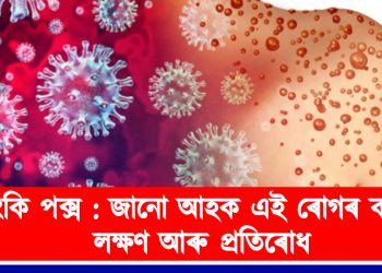 যমৰূপী মাংকি পক্স : জানো আহক এই ৰোগৰ কাৰণ, লক্ষণ আৰু প্ৰতিৰোধ