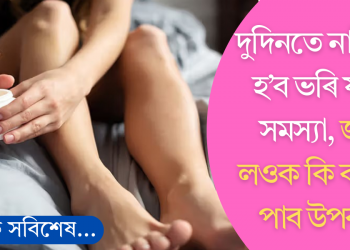 দুদিনতে নাইকিয়া হ’ব ভৰি ফটাৰ সমস্যা, অনুসৰণ কৰক এই সহজ পদ্ধতি; জানি লওক কি কৰিব