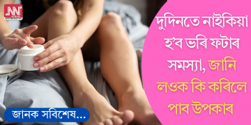 দুদিনতে নাইকিয়া হ’ব ভৰি ফটাৰ সমস্যা, অনুসৰণ কৰক এই সহজ পদ্ধতি; জানি লওক কি কৰিব