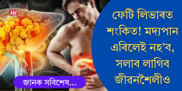 ফেটি লিভাৰত শংকিত? মদ্যপান এৰিলেই যথেষ্ট নহয়, জীৱনত আৰু ৭টা পৰিৱৰ্তন আনিব লাগিব