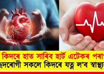 কিদৰে হাত সাৰিব হাৰ্ট এটেকৰ পৰা? হৃদৰোগী সকলে কিদৰে যত্ন ল’ব স্বাস্থ্যৰ?
