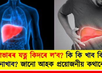 লিভাৰৰ যত্ন কিদৰে ল’ব? কি কি খাব কি কি নাখাব? জানো আহক প্ৰয়োজনীয় কথাবোৰ