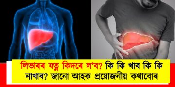 লিভাৰৰ যত্ন কিদৰে ল’ব? কি কি খাব কি কি নাখাব? জানো আহক প্ৰয়োজনীয় কথাবোৰ