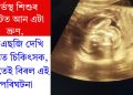 গৰ্ভস্থ শিশুৰ পেটত আন এটা ভ্ৰুণ, ইউএছজি দেখি স্তম্ভিত চিকিৎসক, বিশ্বতেই বিৰল এই পৰিঘটনা