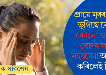 প্ৰায়ে মূৰৰ বিষত ভুগিছে ​​নেকি? কোনো গুৰুতৰ ৰোগৰ লক্ষণ নহয়তো! অৱহেলা কৰিলেই বিপদ