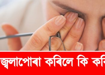 চকু জ্বলাপোৰা কৰিলে কি কৰিব?
