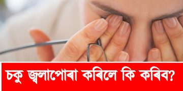 চকু জ্বলাপোৰা কৰিলে কি কৰিব?