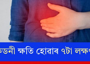 কিডনী ক্ষতি হোৱাৰ ৭টা লক্ষণ…