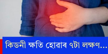 কিডনী ক্ষতি হোৱাৰ ৭টা লক্ষণ…