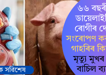 ৬৬ বছৰীয়া ডায়েলাইছিছ ৰোগীৰ দেহত সংৰোপণ কৰা হ’ল গাহৰিৰ কিডনি! মৃত্যু মুখৰ পৰা বাচিল ব্যক্তি