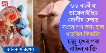 ৬৬ বছৰীয়া ডায়েলাইছিছ ৰোগীৰ দেহত সংৰোপণ কৰা হ’ল গাহৰিৰ কিডনি! মৃত্যু মুখৰ পৰা বাচিল ব্যক্তি