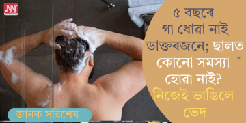 ৫ বছৰে গা ধোৱা নাই ডাক্তৰজনে; ছালত কোনো সমস্যা হোৱা নাই? নিজেই ভাঙিলে ভেদ