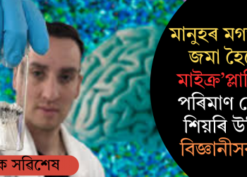 মানুহৰ মগজুতো জমা হৈছে মাইক্ৰ’প্লাষ্টিক? পৰিমাণ দেখি শিয়ৰি উঠিল বিজ্ঞানীসকল