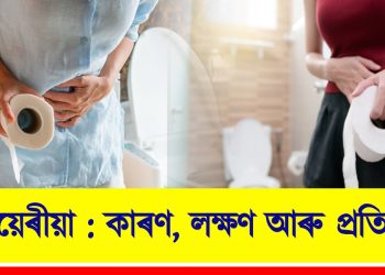 ডায়েৰীয়া : কাৰণ, লক্ষণ আৰু প্ৰতিকাৰ