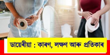 ডায়েৰীয়া : কাৰণ, লক্ষণ আৰু প্ৰতিকাৰ