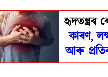 হৃদতন্ত্ৰৰ ৰোগ : কাৰণ, লক্ষণ আৰু প্ৰতিকাৰ