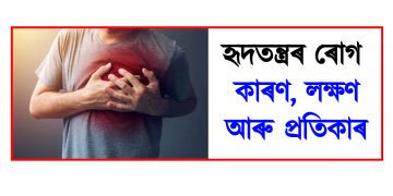 হৃদতন্ত্ৰৰ ৰোগ : কাৰণ, লক্ষণ আৰু প্ৰতিকাৰ