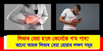 লিভাৰ বেয়া হ’লে কেনেকৈ গ’ম পাব? জানো আহক লিভাৰ বেয়া হোৱাৰ লক্ষণ সমূহ