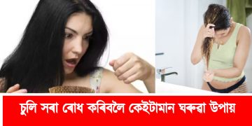 চুলি সৰা ৰোধ কৰিবলৈ কেইটামান ঘৰুৱা উপায়